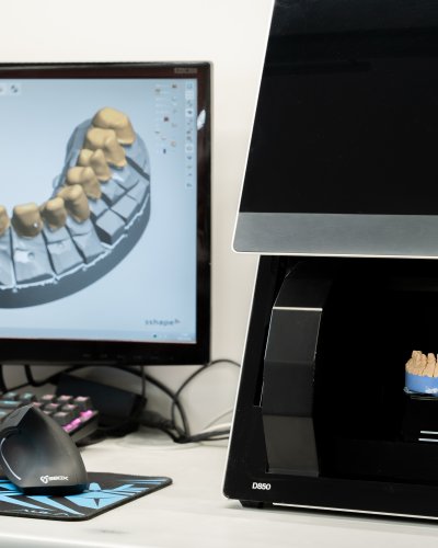 Removable dental bridge