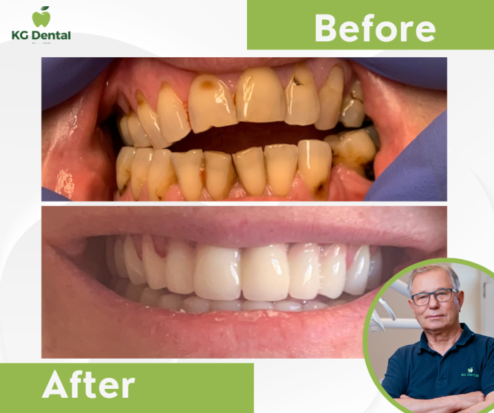 Our reference works and dental results