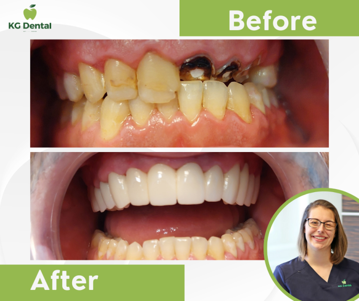 Our reference works and dental results