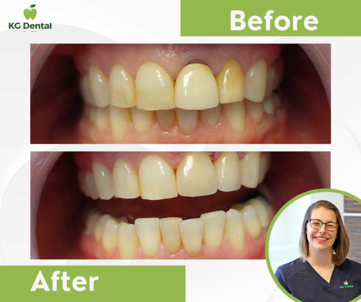 Our reference works and dental results