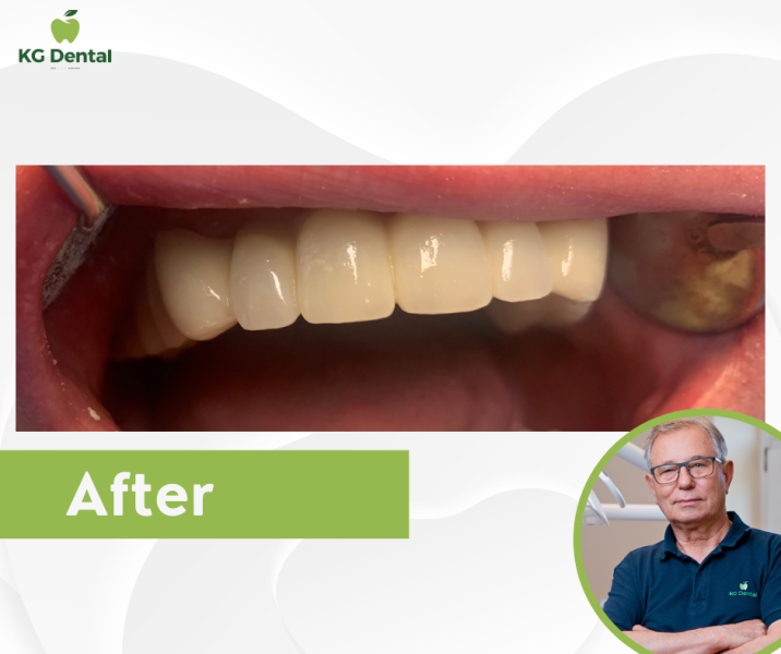 Our reference works and dental results