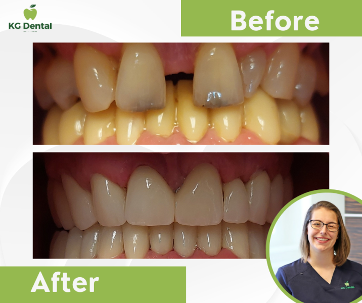 Our reference works and dental results