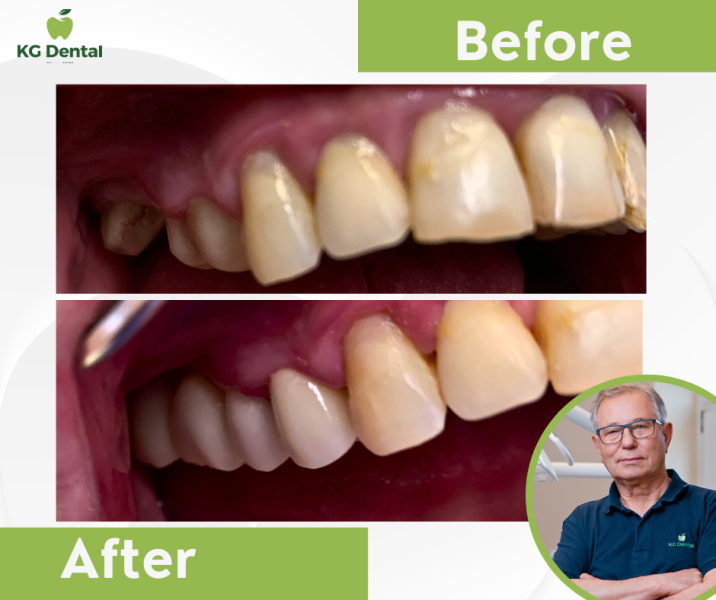 Our reference works and dental results