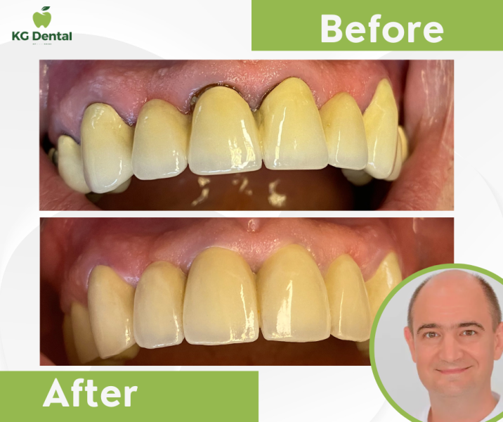 Our reference works and dental results