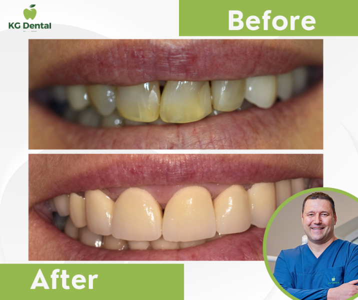 Our reference works and dental results