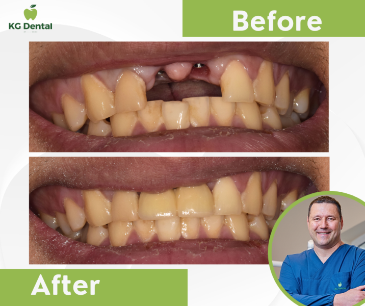 Our reference works and dental results