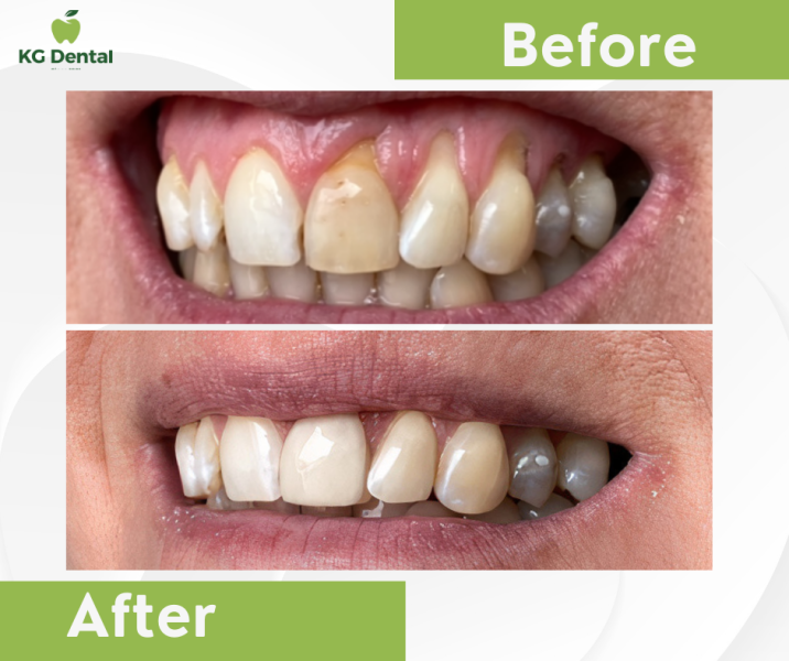 Our reference works and dental results