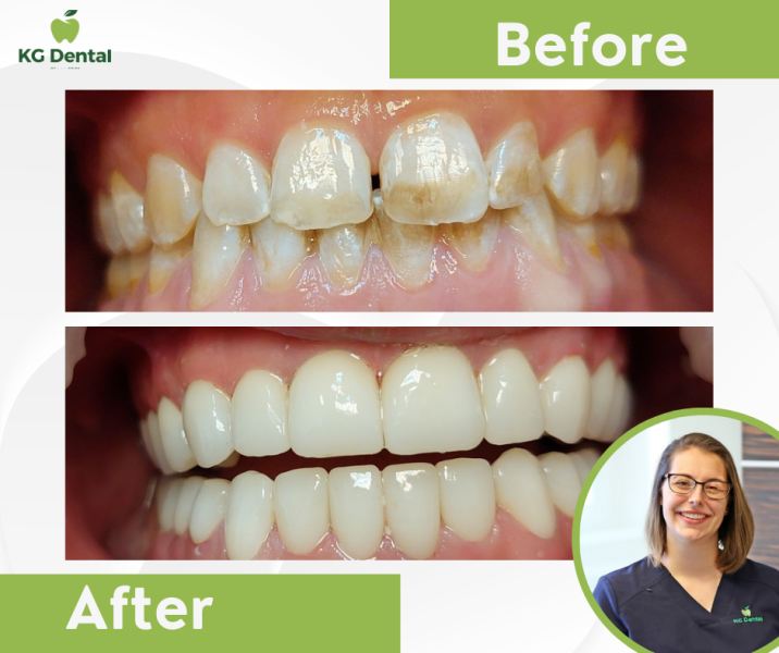 Our reference works and dental results