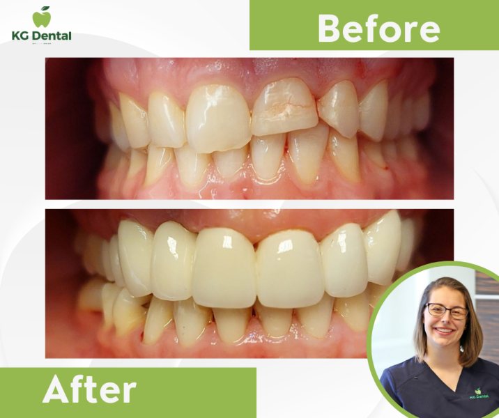 Our reference works and dental results