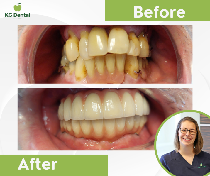 Our reference works and dental results