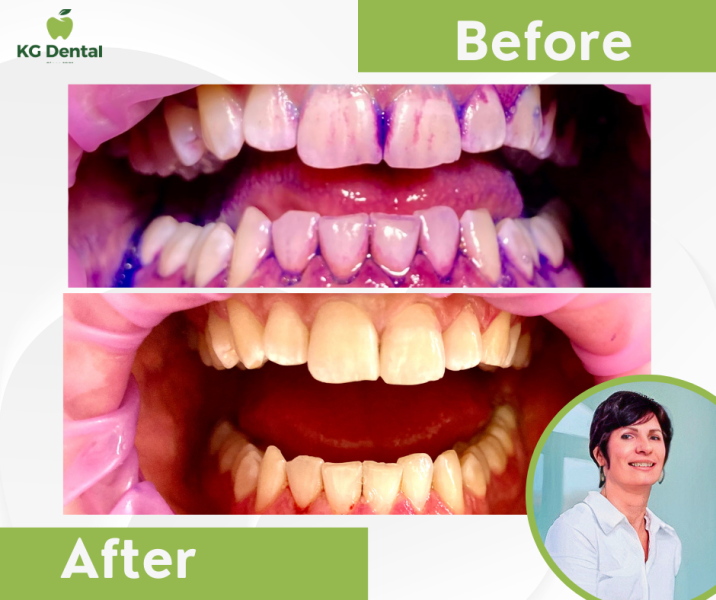 Our reference works and dental results