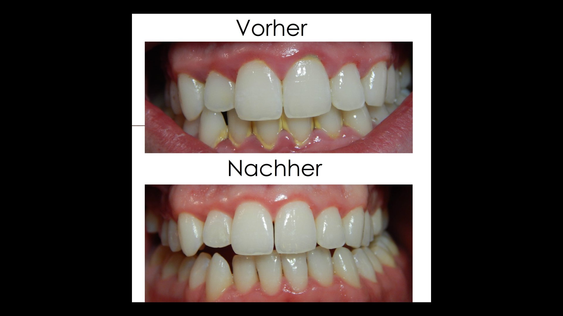 Mundhygiene Am Mittwoch 