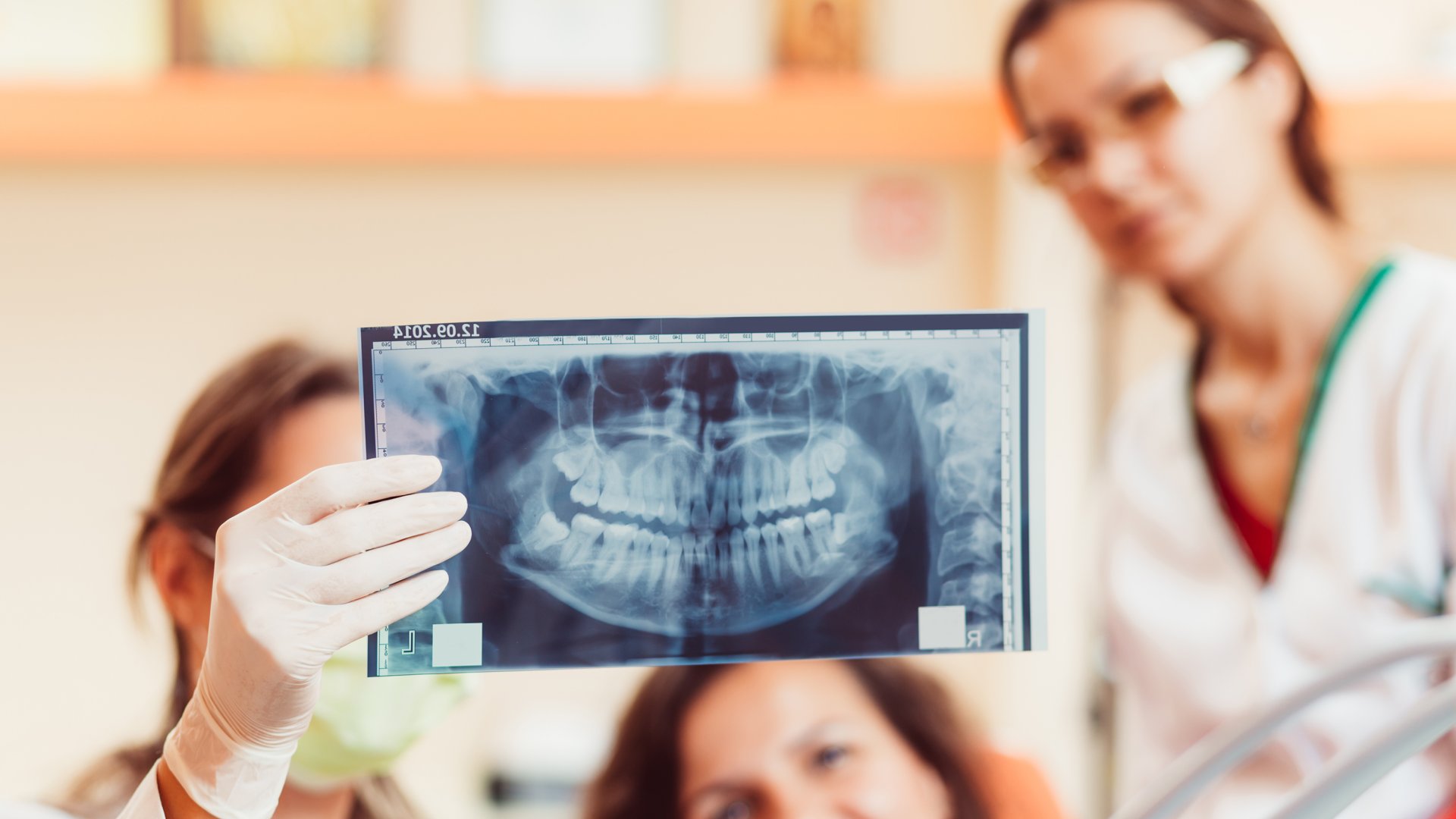 Ursachen für lockere Zähne: was kann die Ursache locker werdende Zähne sein?