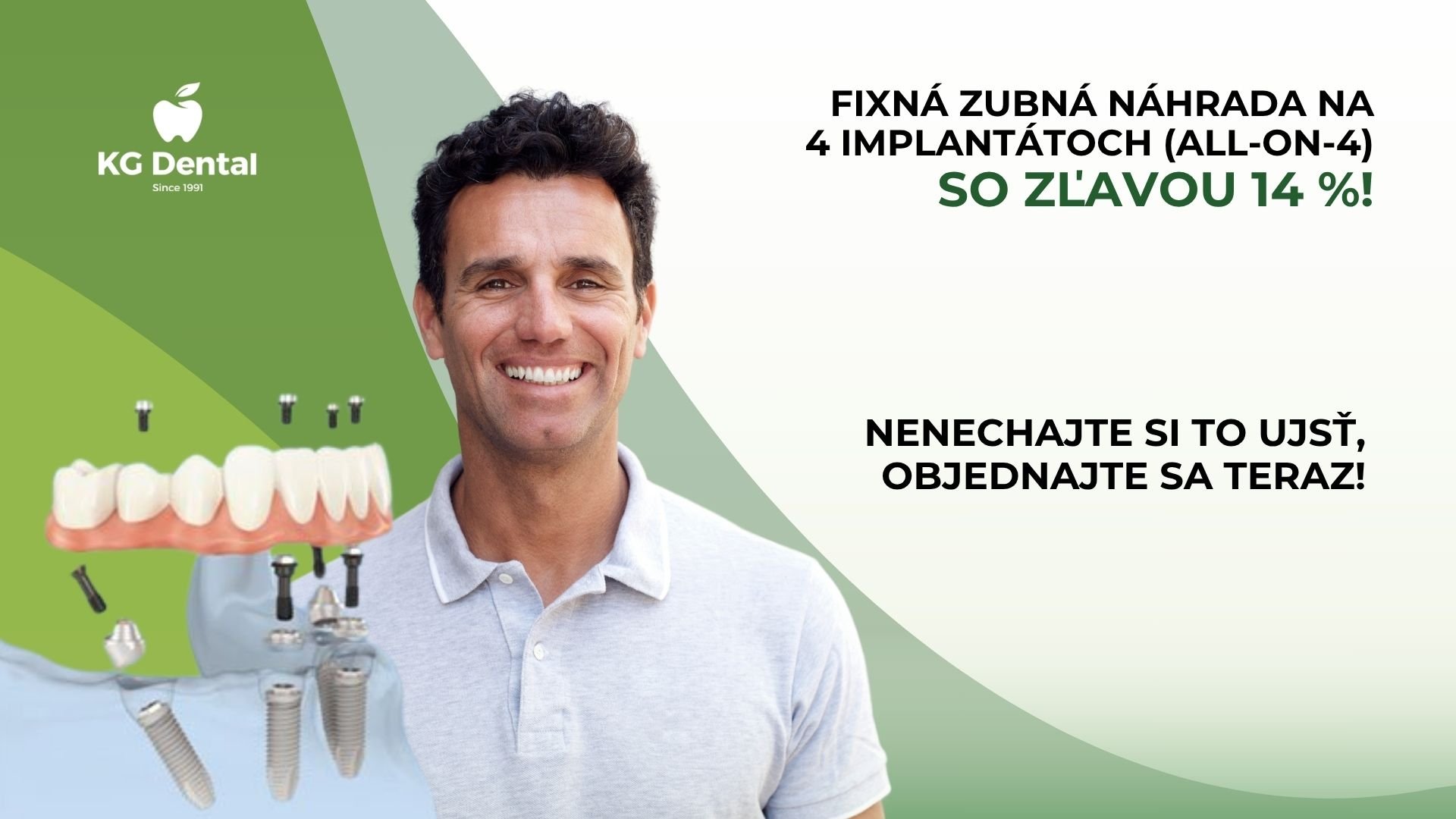 All on 4 zubná náhrada: znovuzrodenie úsmevu