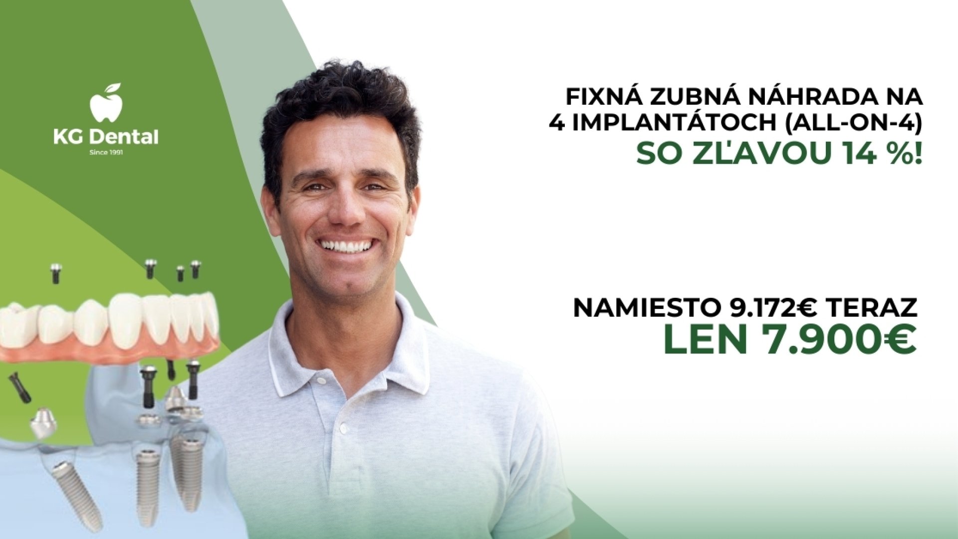 All on 4 zubná náhrada: znovuzrodenie úsmevu