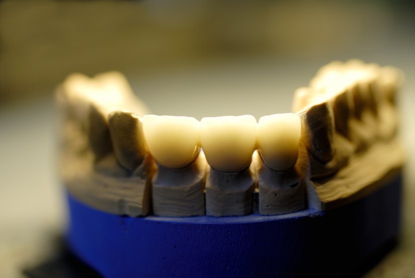 umiestnenie implantátu