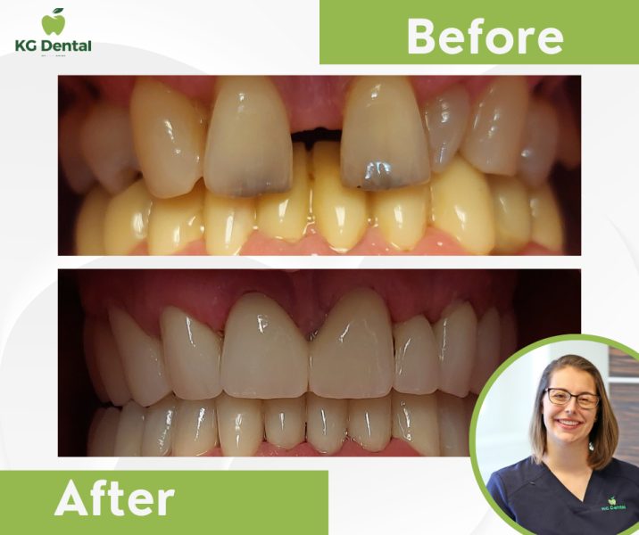 Dentures before and after dental treatment with a smiling photo of the doctor performing the treatment.