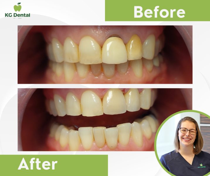 Denture before and after dental treatment with a smiling photo of the doctor performing the treatment.