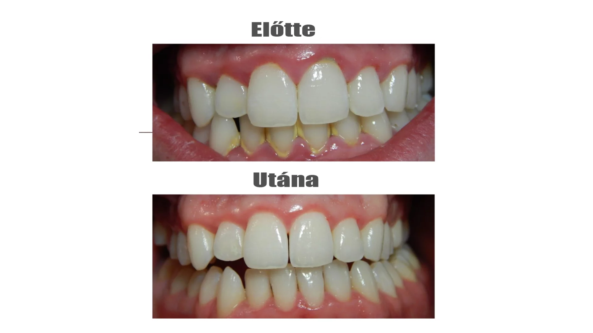 Szájhigiéniai akciós napok a KG Dentalban