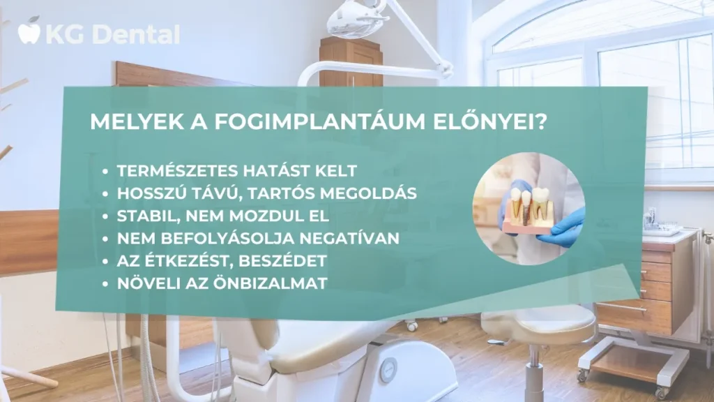 A fogimplantátum előnyeit felsoroló infografika.